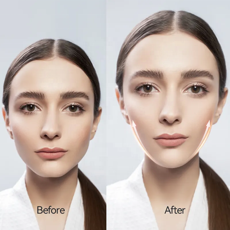 V-Face Chin Lift Facial Device - Face Lift Device for Jawline and Neck